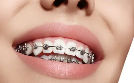 Braces and Confidence: How Orthodontics Can Transform Your Life