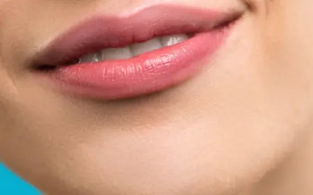 How is Lip Augmentation Performed in Islamabad?