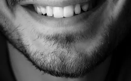 Transform Your Smile with Teeth Whitening Services Now