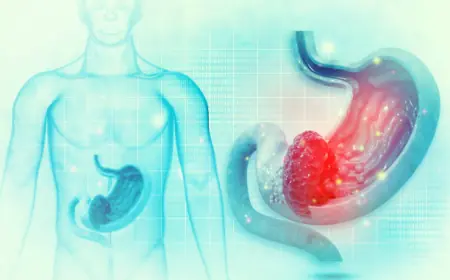 Choosing Your Gastric Balloon Center Riyadh