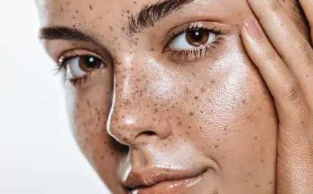 What Is Mesotherapy and How Does It Work?