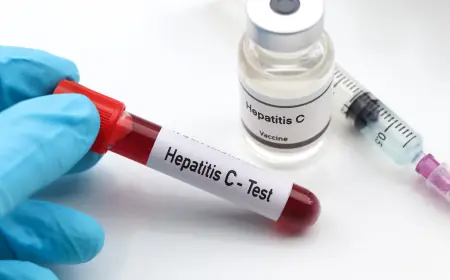 Why get a Hepatitis C test in Dubai early?