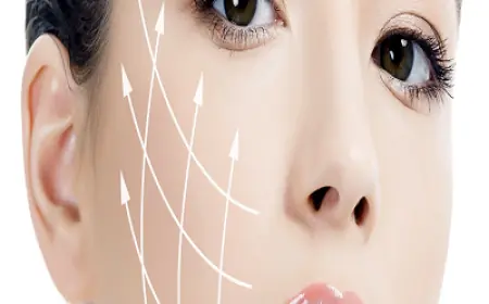 Are Thread Lifts Safe in Islamabad? What Do Experts Say?