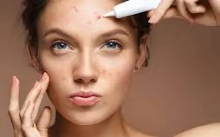 Tretiva 40 mg: The Strong Solution for Stubborn Acne