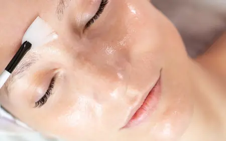 Chemical Peels for Fading Stubborn Dark Spots