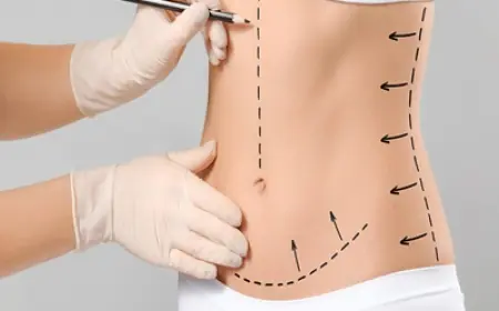 Mini Abdominoplasty in Dubai: What Happens During the Procedure?