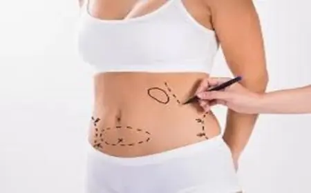 شفط الدهون بدون ألم: الواقع في عيادات الرياض