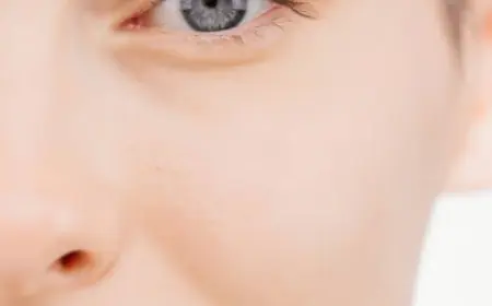 Everything About Alarplasty in Riyadh