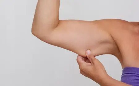 Can Non-Surgical Treatments Help with Arm Sculpting?