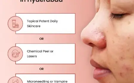 Melasma Treatment: Regain Clear, Even-Toned Skin