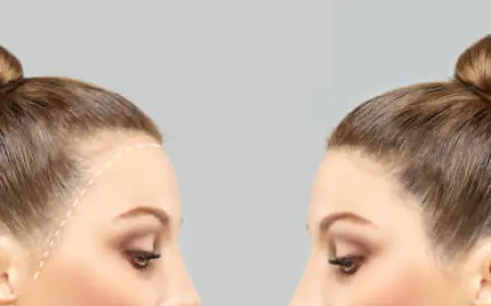 تجارب زراعة الشعر في الرياض.. اكتشف الحل المثالي لك