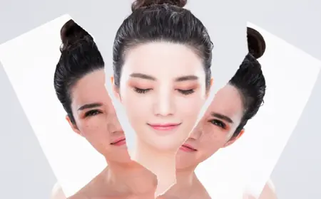 Skin Whitening Treatment: Reveal Your Radiance