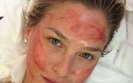 How Effective Is a Vampire Facial for Glowing Skin?