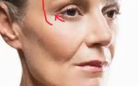 Can I Try Skin Tightening Before Considering Surgery?