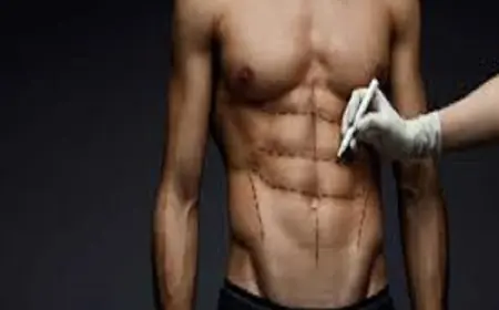 مقارنة بين تكلفة الشفط التقليدي والفيزر في عيادات الرياض