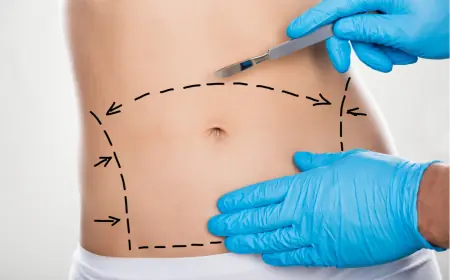 What Does a Tummy Tuck Surgery Actually Involve?
