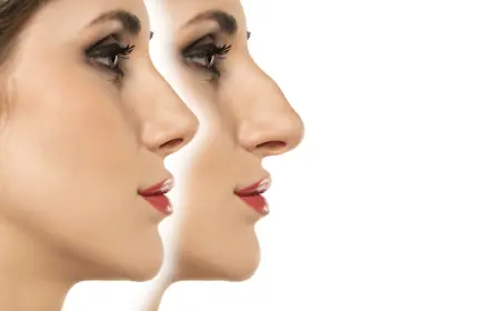 Cost of Preservation Rhinoplasty in Dubai: What You Need to Know