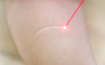 Why Laser Scar Removal Cost in Dubai Varies So Much