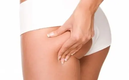 What Makes Riyadh a Popular Destination for Thigh Lift Surgery?