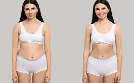 ما هو السعر المناسب لإبرة مونجارو في الإمارات؟