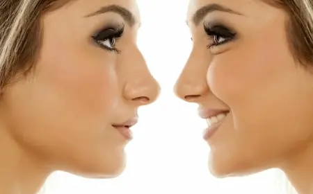 What is Ultrasonic Rhinoplasty and How Does It Work in Dubai?