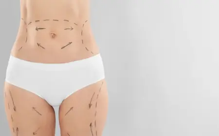 Best Time to Book a Tummy Tuck Surgery