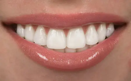 Are Composite Veneers Reversible? A Look at the Facts