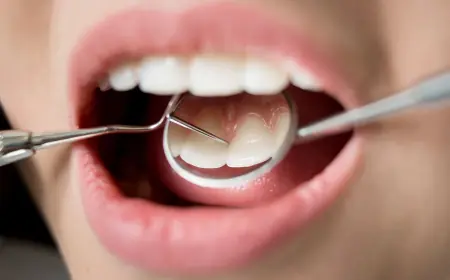 How to Maintain Results After a Professional Cleaning