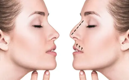 Get Inspired by the Best Rhinoplasty Surgeon