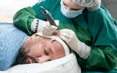 How Much Does Hair Restoration Cost at a Clinic?