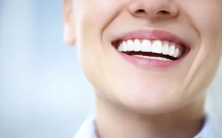 Teeth Whitening for Sensitive Teeth: Options That Don’t Hurt