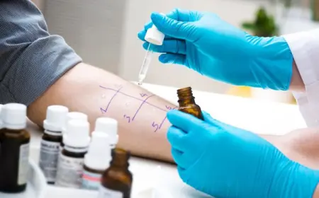 The Role of Allergy Urgent Care in Managing Chronic Allergies