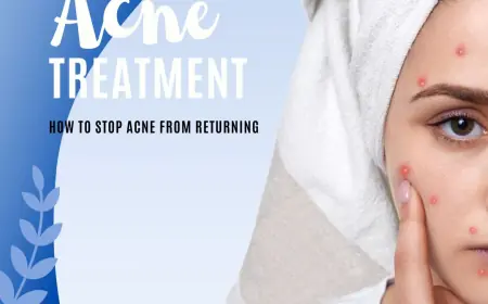 Clear Up Acne Fast with Isotroin 10mg Capsule