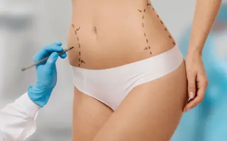 What Is Tummy Tuck Surgery and How Does It Work?