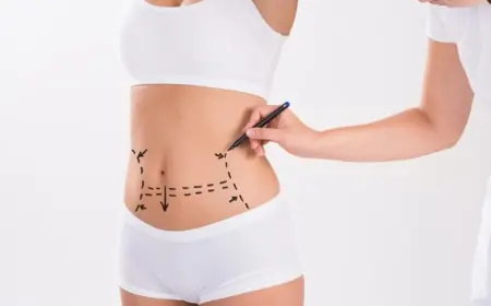 Before and After a Tummy Tuck in Islamabad: What Changes to Expect