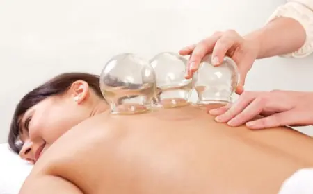 How does Myofascial Cupping Therapy help with Back Pain and Sciatica?
