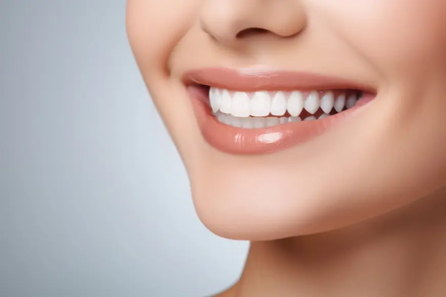 Do’s and Don’ts After Getting Composite Veneers