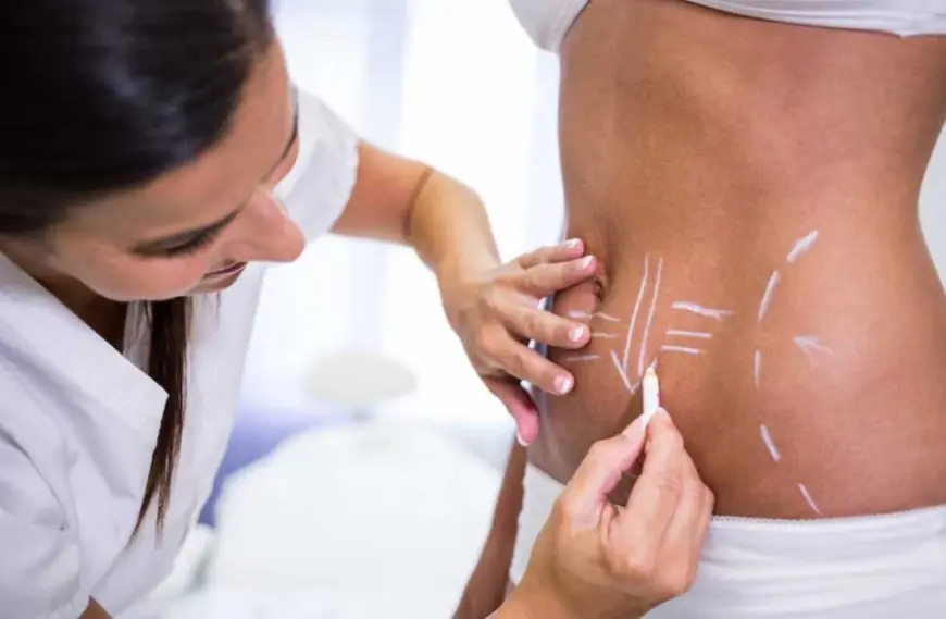 Is Liposuction in Islamabad Budget-Friendly? Find Out