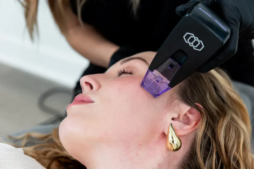 Snatched Radiance Revolution with Morpheus8 Treatment
