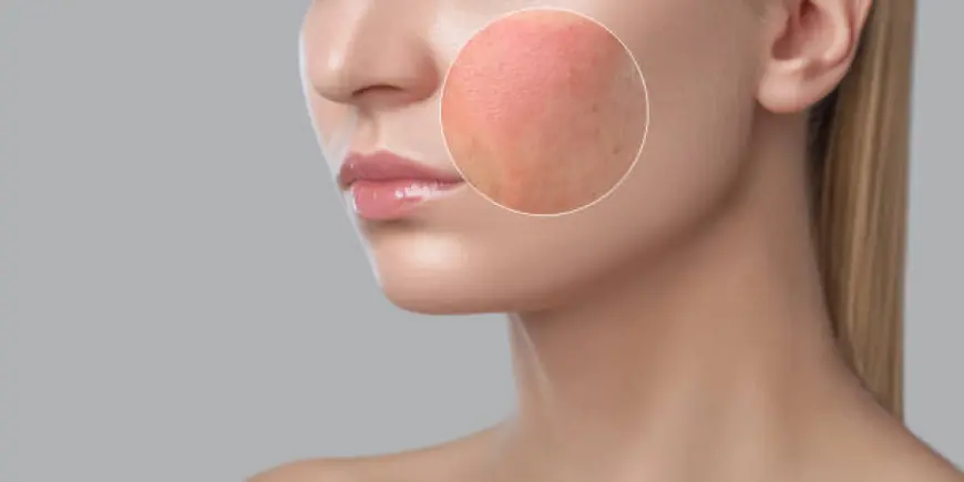 Large Pores: Targeted Treatments That Work