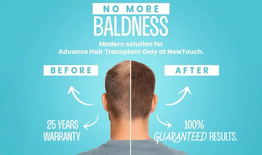 How To Choose The Right Hair Transplant Clinic Today?