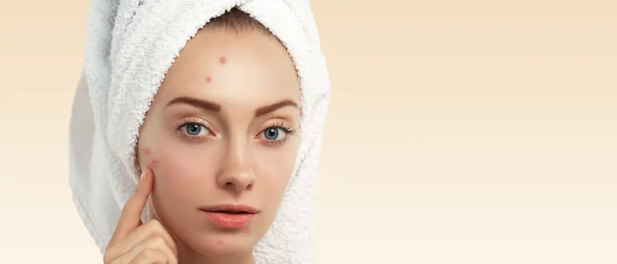 Closed Comedones Treatment in Dubai: Clear Skin Starts Here