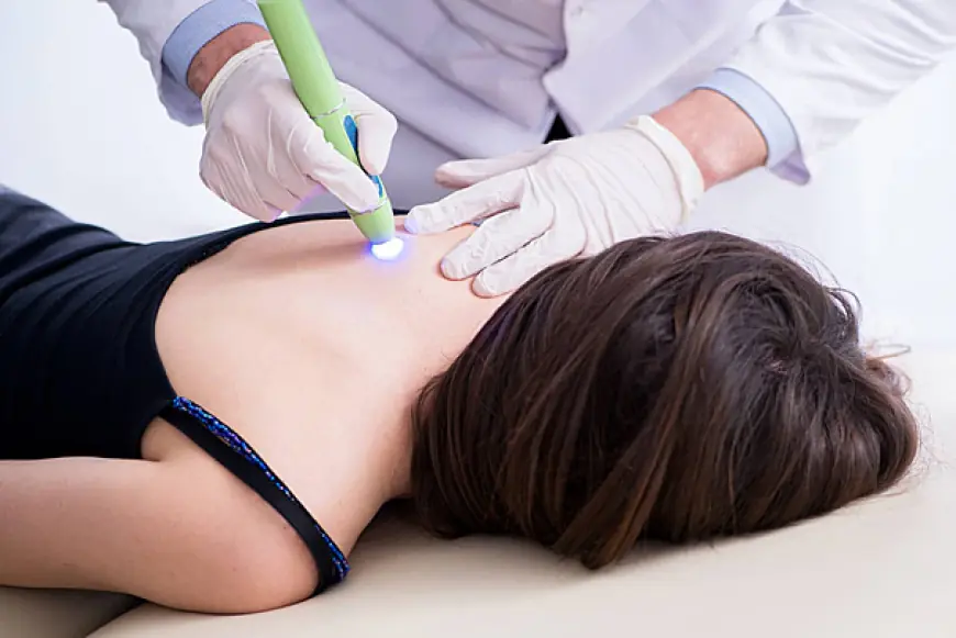 Scar Laser Treatment: Best Time to Start