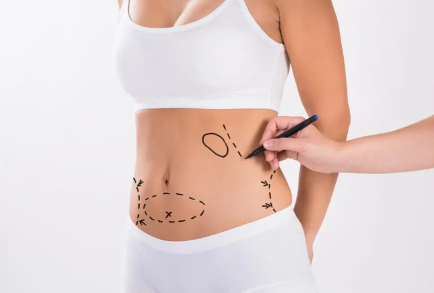 Confident and Stylish What to Wear in Dubai After Liposuction Surgery