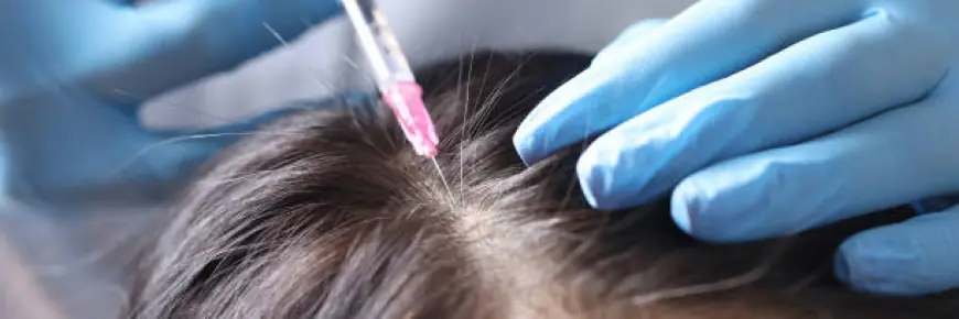 زراعة الشعر في الرياض: استعيد ثقتك مع خبراء التجميل