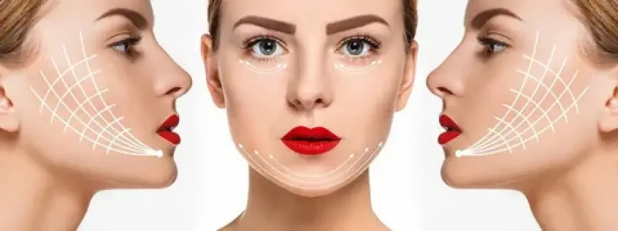 Is the Face Thread Lift Price in Islamabad Worth It?
