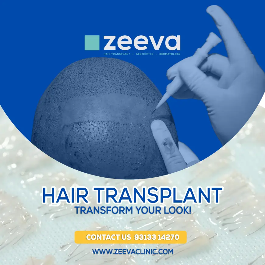 How To Find The Best Hair Transplant In Gujarat For Natural Results!