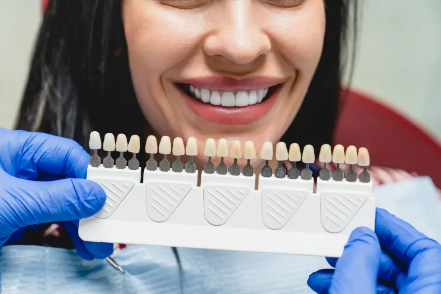 Your Complete Guide to Getting a Confident Smile with Veneers in Islamabad