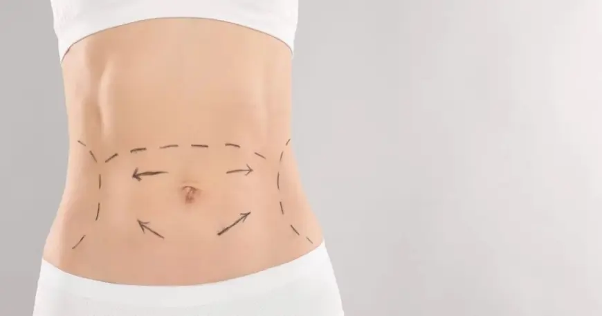 Top-Rated Cosmetic Surgery Centers for Mini Tummy Tuck in Dubai