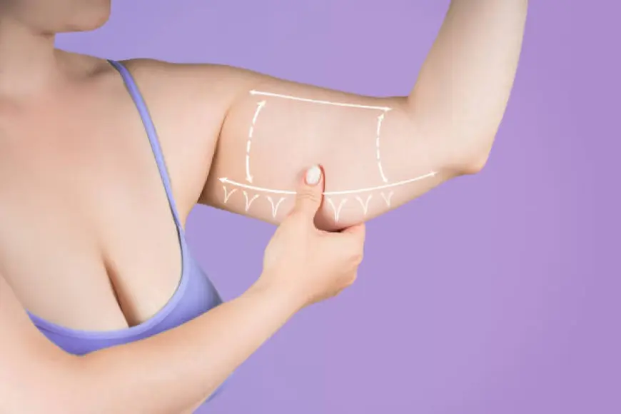 Riyadh: Plastic Surgeon for Arm Lift? Redefining Upper Arm Contours